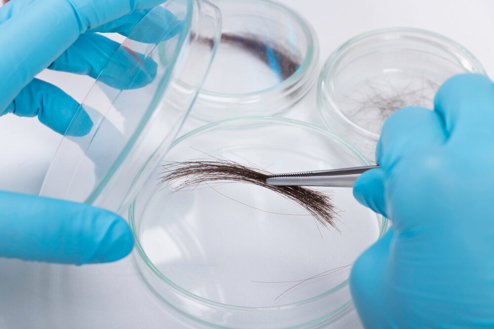 hair follicle drug test for weed