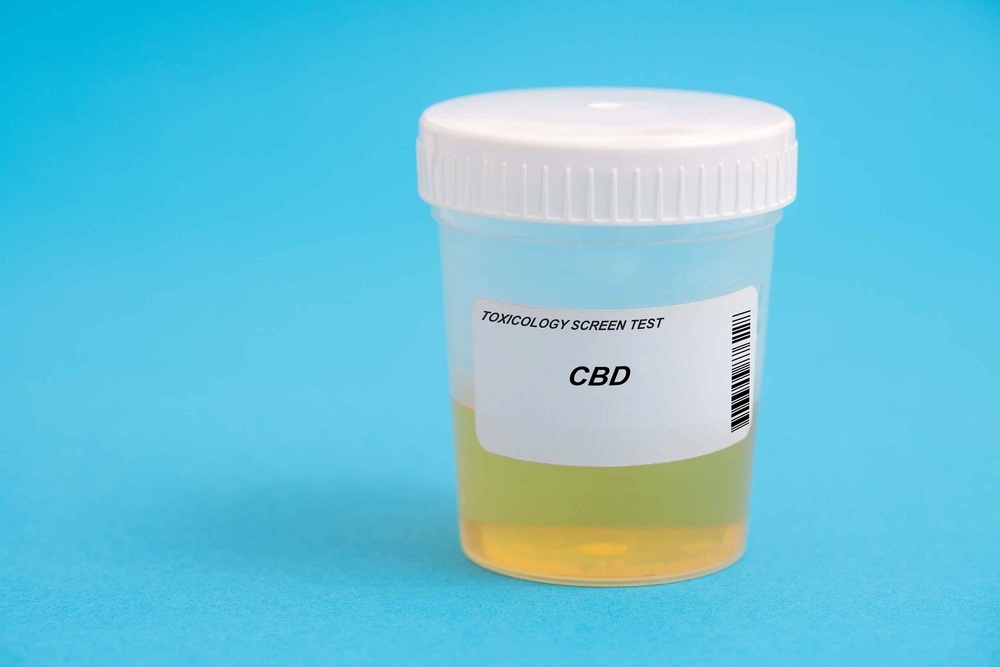 urine in a medical cbd test tub